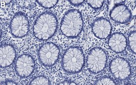 Anti-RET Antibody, clone 2K12 ZooMAb&#174; Rabbit Monoclonal recombinant, expressed in HEK 293 cells