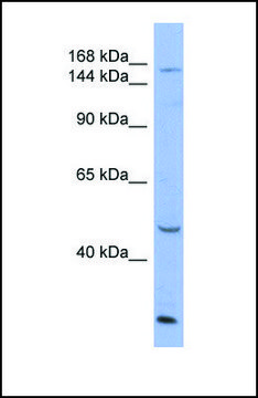 Anti-ATP7A antibody produced in rabbit affinity isolated antibody