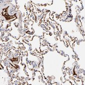 Anti-C3 antibody produced in rabbit Prestige Antibodies&#174; Powered by Atlas Antibodies, affinity isolated antibody, buffered aqueous glycerol solution
