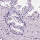 Anti-HSD17B1 antibody produced in rabbit Prestige Antibodies&#174; Powered by Atlas Antibodies, affinity isolated antibody, buffered aqueous glycerol solution