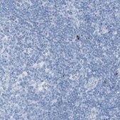 Anti-LAG3 antibody produced in rabbit Prestige Antibodies&#174; Powered by Atlas Antibodies, affinity isolated antibody, buffered aqueous glycerol solution