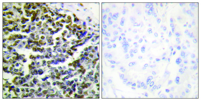 Anti-TCOF1, N-Terminal antibody produced in rabbit affinity isolated antibody