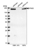 Anti-ATAD2 antibody produced in rabbit Prestige Antibodies&#174; Powered by Atlas Antibodies, affinity isolated antibody, buffered aqueous glycerol solution