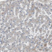 Anti-ALPL antibody produced in rabbit Ab1, Prestige Antibodies&#174; Powered by Atlas Antibodies, affinity isolated antibody, buffered aqueous glycerol solution