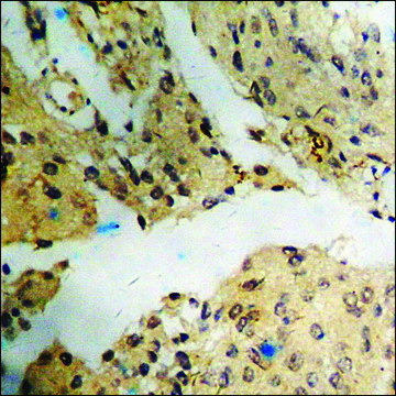 Anti-phospho-ATF2 (pThr71 or 53) antibody produced in rabbit affinity isolated antibody