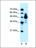 Anti-ENO1 antibody produced in rabbit affinity isolated antibody