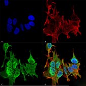 Monoclonal Anti-Gaba-B Receptor 2 - Biotin antibody produced in mouse clone S81-2, purified immunoglobulin