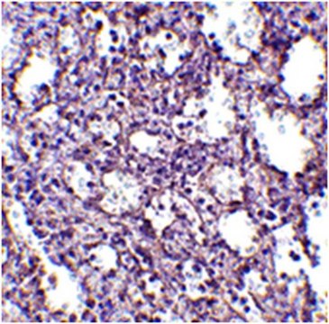 Anti-STIM2 Antibody from rabbit, purified by affinity chromatography