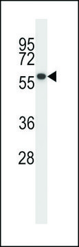 ANTI-PPM1D (CENTER) antibody produced in rabbit affinity isolated antibody, buffered aqueous solution