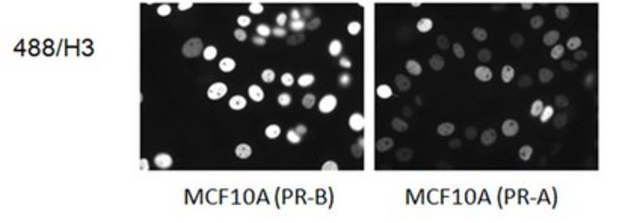 Anti-Progesterone Receptor A/B Antibody, clone 488/H3 clone 488/H3, from mouse