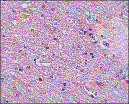 Anti-TMEM16B antibody produced in rabbit affinity isolated antibody, buffered aqueous solution