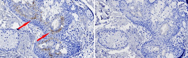 Anti-Integrin &#945;2 Antibody, clone 1E17 ZooMAb&#174; Rabbit Monoclonal recombinant, expressed in HEK 293 cells