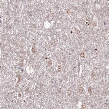 Anti-TBC1D25 antibody produced in rabbit Prestige Antibodies&#174; Powered by Atlas Antibodies, affinity isolated antibody, buffered aqueous glycerol solution