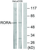 Anti-RORA, N-Terminal antibody produced in rabbit affinity isolated antibody