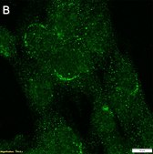 Anti-LRBA Antibody, clone 3H22 ZooMAb&#174; Rabbit Monoclonal recombinant, expressed in HEK 293 cells