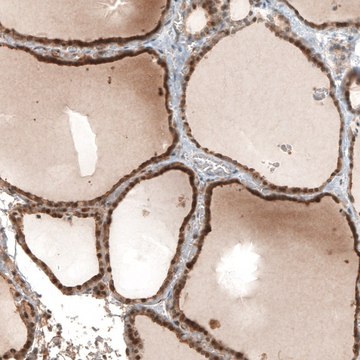 Anti-STC1 antibody produced in rabbit Prestige Antibodies&#174; Powered by Atlas Antibodies, affinity isolated antibody, buffered aqueous glycerol solution