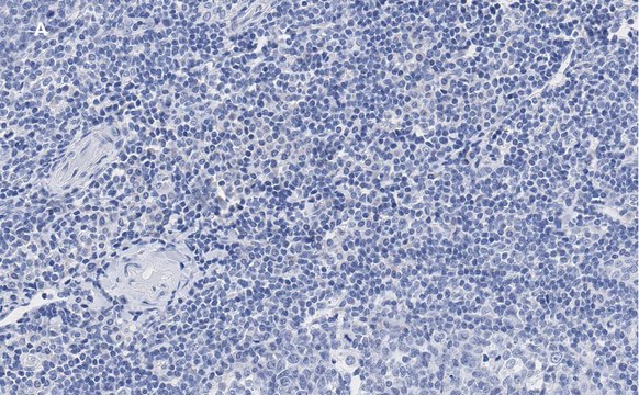 Anti-vWF Antibody, clone 1B21, ZooMAb&#174; Rabbit Monoclonal recombinant, expressed in HEK 293 cells