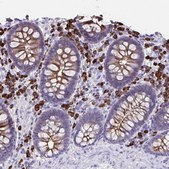 Anti-JCHAIN antibody produced in rabbit Prestige Antibodies&#174; Powered by Atlas Antibodies, affinity isolated antibody, buffered aqueous glycerol solution