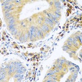 Anti-MANF antibody produced in rabbit