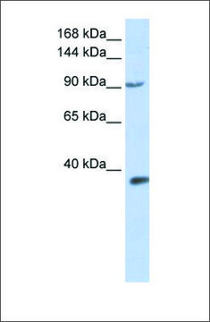 Anti-EPAS1 antibody produced in rabbit affinity isolated antibody