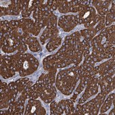 Anti-IDH3B antibody produced in rabbit Prestige Antibodies&#174; Powered by Atlas Antibodies, affinity isolated antibody, buffered aqueous glycerol solution