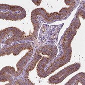 Anti-WARS2 antibody produced in rabbit Prestige Antibodies&#174; Powered by Atlas Antibodies, affinity isolated antibody