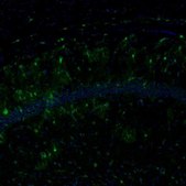Anti-ECH1 antibody produced in rabbit Prestige Antibodies&#174; Powered by Atlas Antibodies, affinity isolated antibody, buffered aqueous glycerol solution