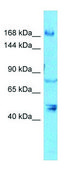 Anti-DAPK1 (N-terminal) antibody produced in rabbit affinity isolated antibody