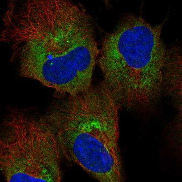Anti-Hdlbp Antibody Produced In Rabbit Prestige Antibodies&#174; Powered by Atlas Antibodies, affinity isolated antibody, buffered aqueous glycerol solution