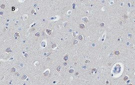 Anti-Huntingtin Protein Antibody, clone 1M11, ZooMAb&#174; Rabbit Monoclonal recombinant, expressed in HEK 293 cells