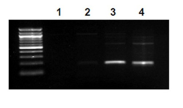 EZ-Magna ChIP&#174; A - Chromatin Immunoprecipitation Kit Single day chromatin immunoprecipitation (ChIP) kit containing all necessary reagents to perform 22 individual chromatin immunoprecipitation (ChIP) reactions using magnetic A beads. Control primers included.