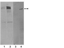 ATM/Chk2 Pathway Explorer Antibody MiniPack Upstate&#174;, from mouse, unconjugated