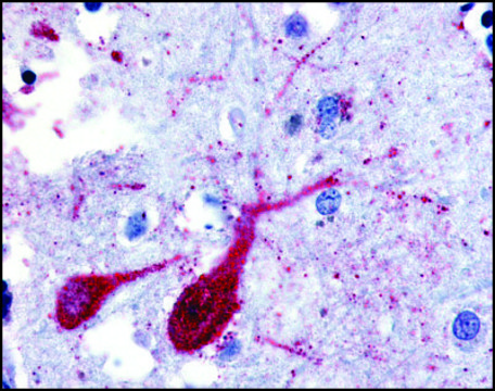 Anti-SLC5A9 (AB3) antibody produced in rabbit affinity isolated antibody, buffered aqueous solution