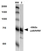 Monoclonal Anti-Lrrk2/Dardarin - Rpe antibody produced in mouse clone S138-6, purified immunoglobulin