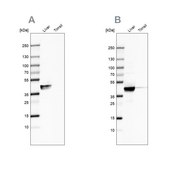 Anti-ACAT1 antibody produced in rabbit Ab1, Prestige Antibodies&#174; Powered by Atlas Antibodies, affinity isolated antibody, buffered aqueous glycerol solution