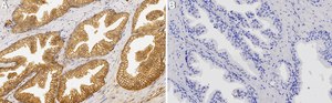 Anti-CTNND1/p120CTN Antibody, clone 2C22 ZooMAb&#174; Rabbit Monoclonal recombinant, expressed in HEK 293 cells