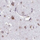 Anti-RPS15 antibody produced in rabbit Prestige Antibodies&#174; Powered by Atlas Antibodies, affinity isolated antibody, buffered aqueous glycerol solution