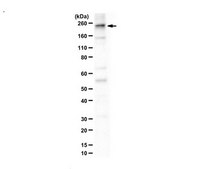 Anti-SYCP2 serum, from rabbit