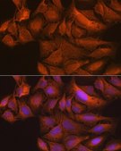 Anti-TBK1/NAK antibody produced in rabbit