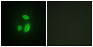 Anti-SEPARASE antibody produced in rabbit affinity isolated antibody