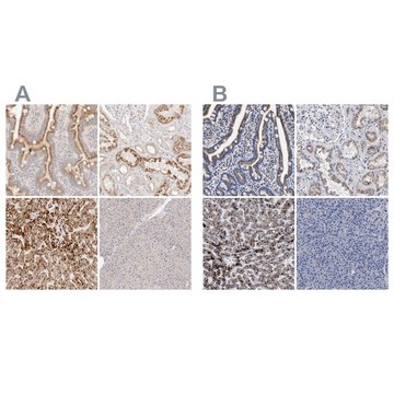 Anti-ACOX1 antibody produced in rabbit Prestige Antibodies&#174; Powered by Atlas Antibodies, affinity isolated antibody, buffered aqueous glycerol solution