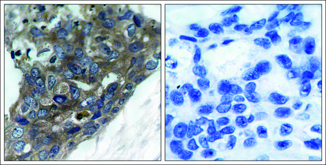 Anti-MAP3K5 (Ab-966) antibody produced in rabbit affinity isolated antibody