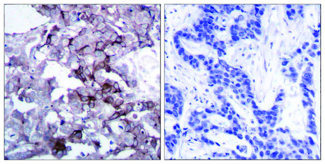 Anti-EGFR antibody produced in rabbit affinity isolated antibody