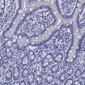 Anti-SLC1A2 antibody produced in rabbit Prestige Antibodies&#174; Powered by Atlas Antibodies, affinity isolated antibody, buffered aqueous glycerol solution