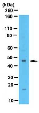 Anti-Zinc Finger Protein 260 Antibody serum, from rabbit