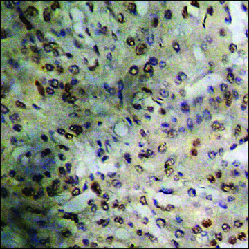 Anti-phospho-FOXO1A (pSer329) antibody produced in rabbit affinity isolated antibody