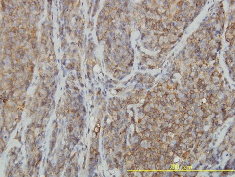 Monoclonal Anti-RHOA antibody produced in mouse clone 1B12, purified immunoglobulin, buffered aqueous solution