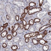 Anti-MARCH3 antibody produced in rabbit Prestige Antibodies&#174; Powered by Atlas Antibodies, affinity isolated antibody, buffered aqueous glycerol solution