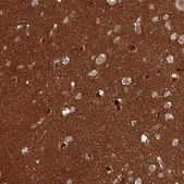 Anti-CRBN antibody produced in rabbit Prestige Antibodies&#174; Powered by Atlas Antibodies, affinity isolated antibody, buffered aqueous glycerol solution