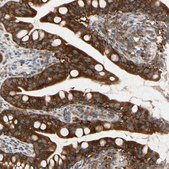 Anti-RPS6KA1 antibody produced in rabbit Prestige Antibodies&#174; Powered by Atlas Antibodies, affinity isolated antibody, buffered aqueous glycerol solution